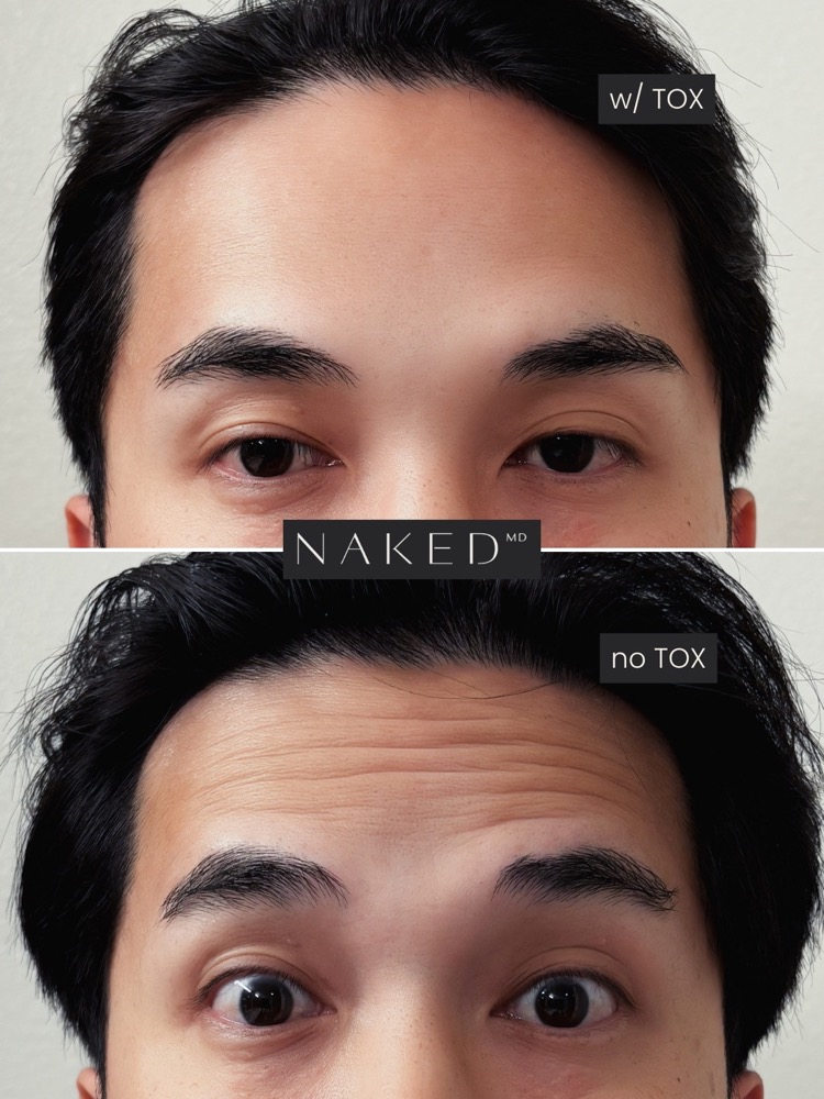 NAKED MD post, still, 2026-09-10