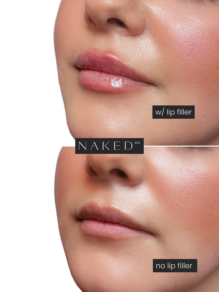 NAKED MD post, still, 2026-08-19