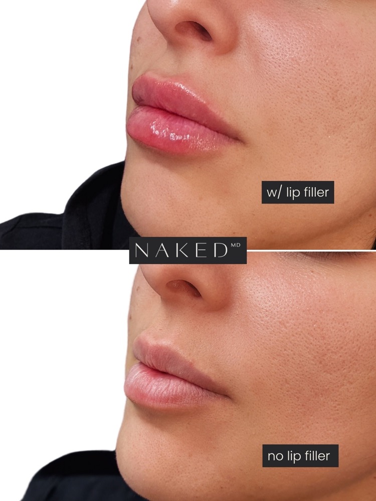 NAKED MD post, still, 2026-08-11