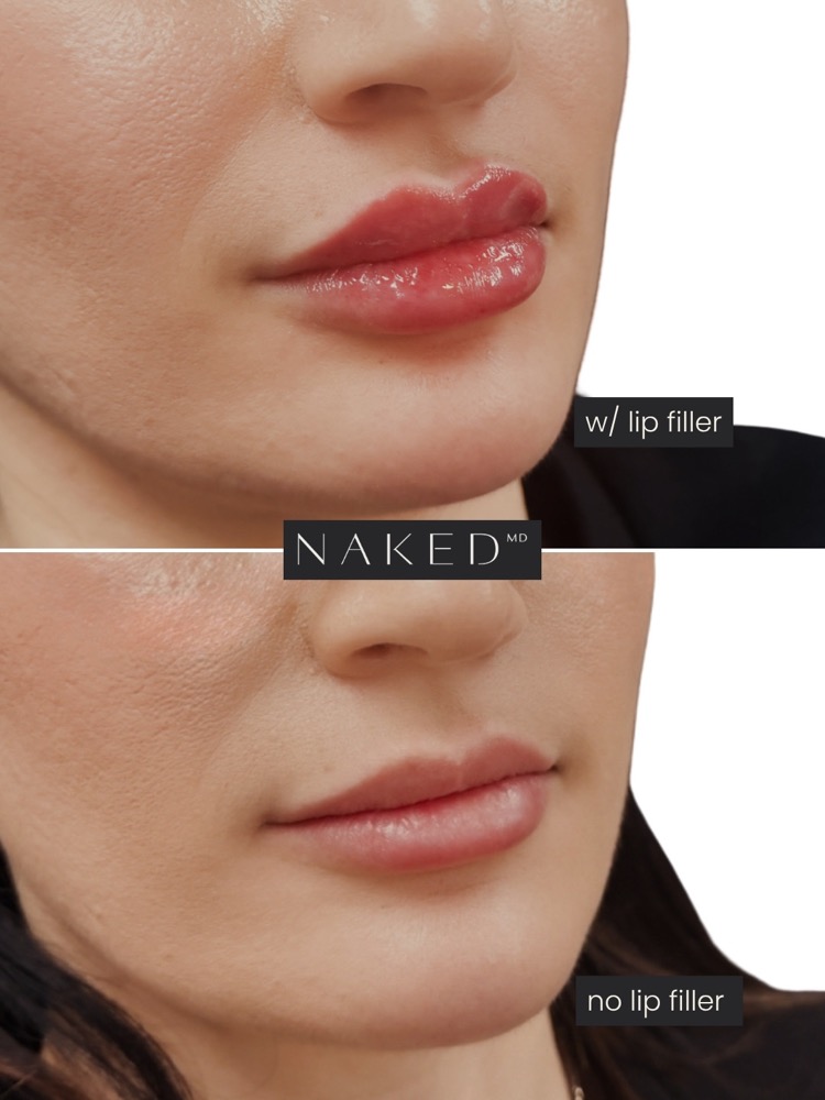 NAKED MD still, 2026-07-29