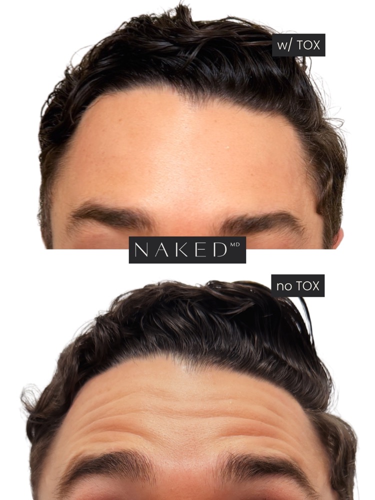 NAKED MD still, 2026-07-13