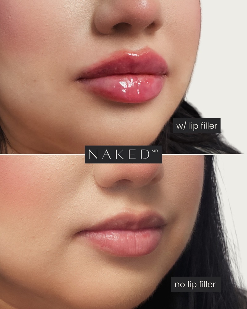 NAKED MD still, 2026-07-02